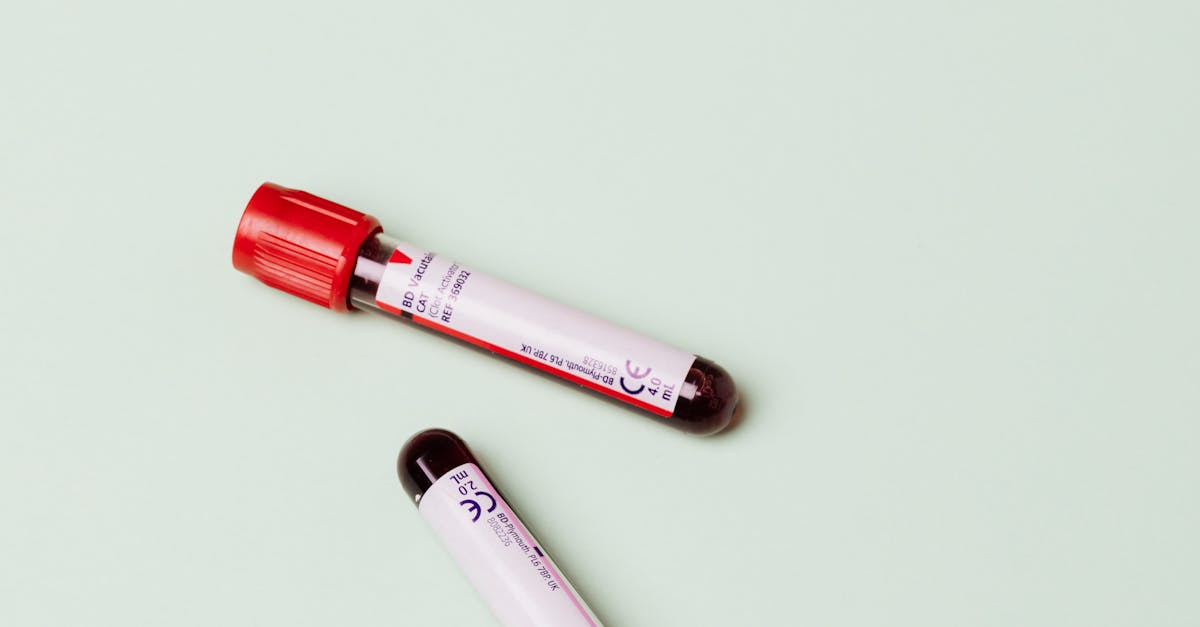 Ultrasonido de Mama en Plaza San Miguel Izcalli