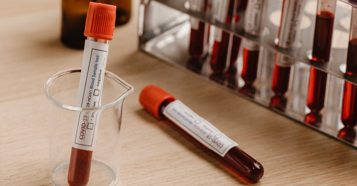 Radiografia AP y Lateral de los Manos en Plaza San Miguel