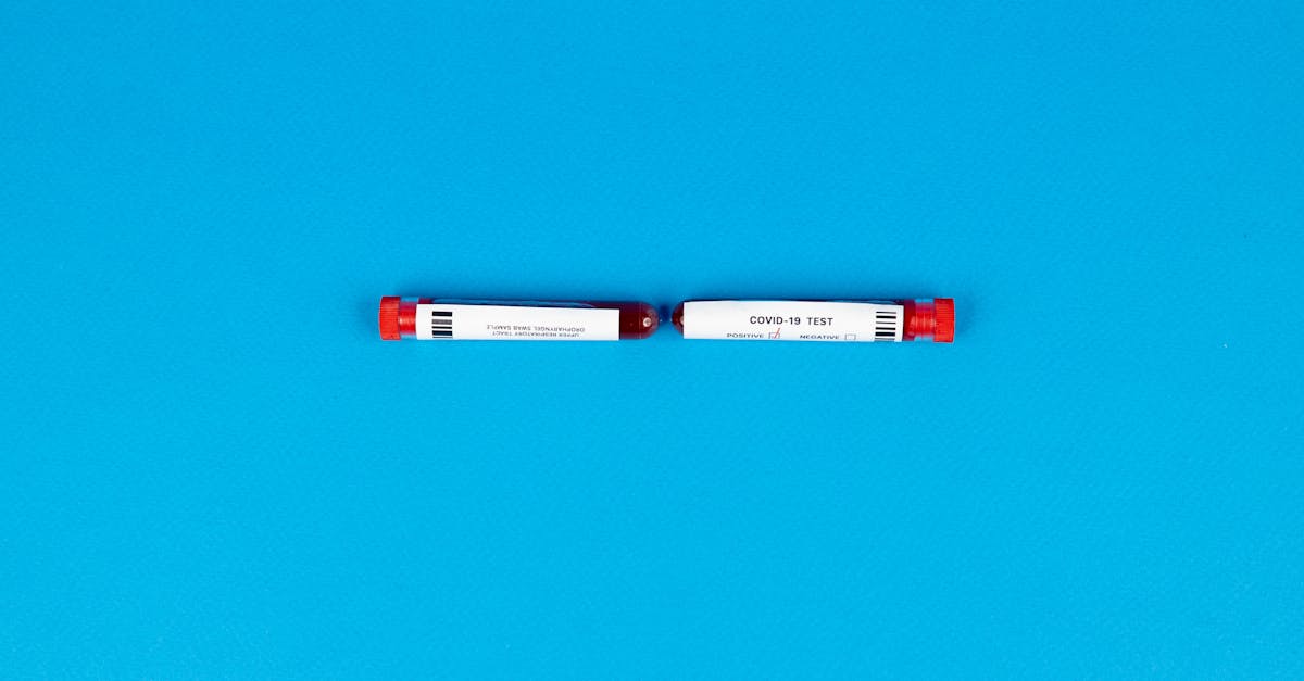 Ultrasonido en Plaza San Miguel Izcalli